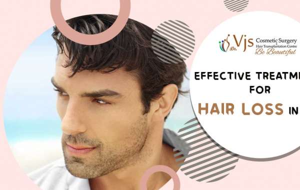 Hair loss: What are the best and effective 10 hair loss treatments for men?